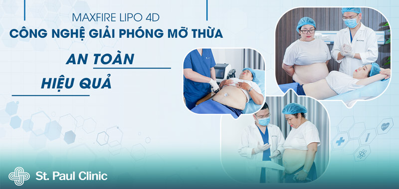 Công nghệ giảm béo MaxFire Lipo 4D giúp lấy lại vóc dáng nhanh chóng và an toàn