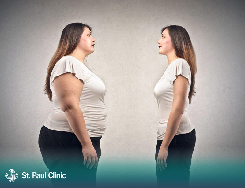 Bật mí 1 số lưu ý khi giảm béo toàn thân giúp đạt hiệu quả cao nhất