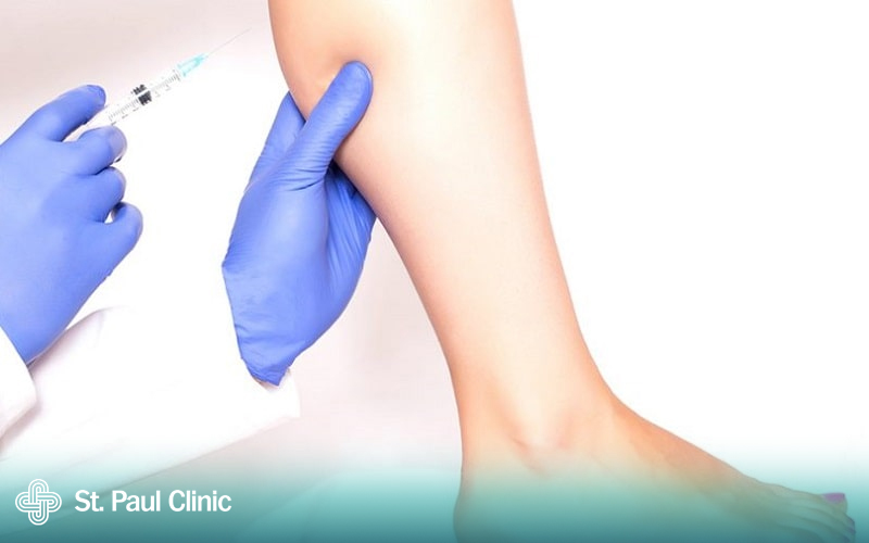 Quy trình tiêm tan mỡ chân chuẩn y khoa gồm 5 bước