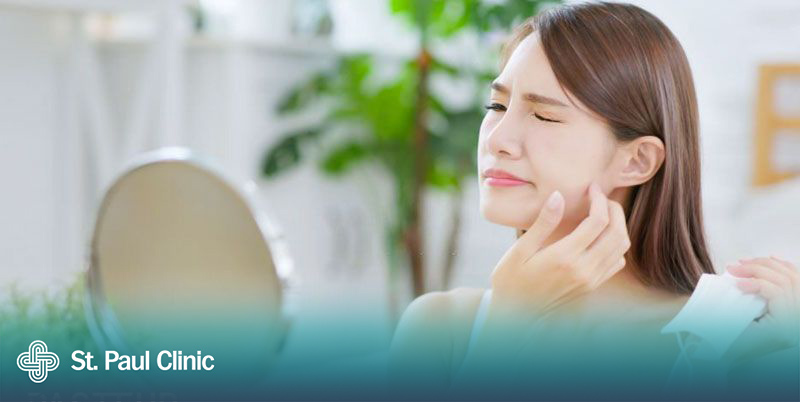 Tiêm tan mỡ bị ngứa vùng mặt và cách điều trị hiệu quả