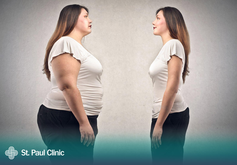 Tình trạng mỡ thừa cũng là yếu tó ảnh hưởng đến chi phí giảm béo