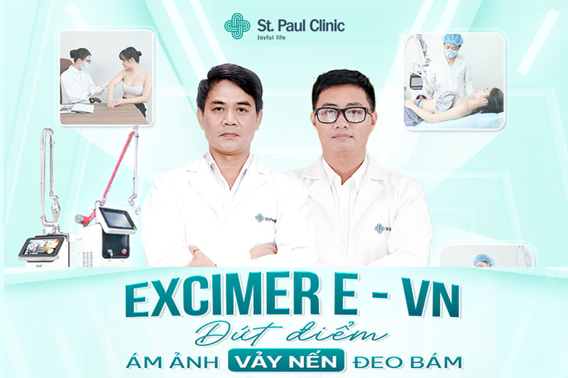 Công nghệ Excimer E-VN tại St.Paul xóa bỏ sự đeo bám bệnh vảy nến